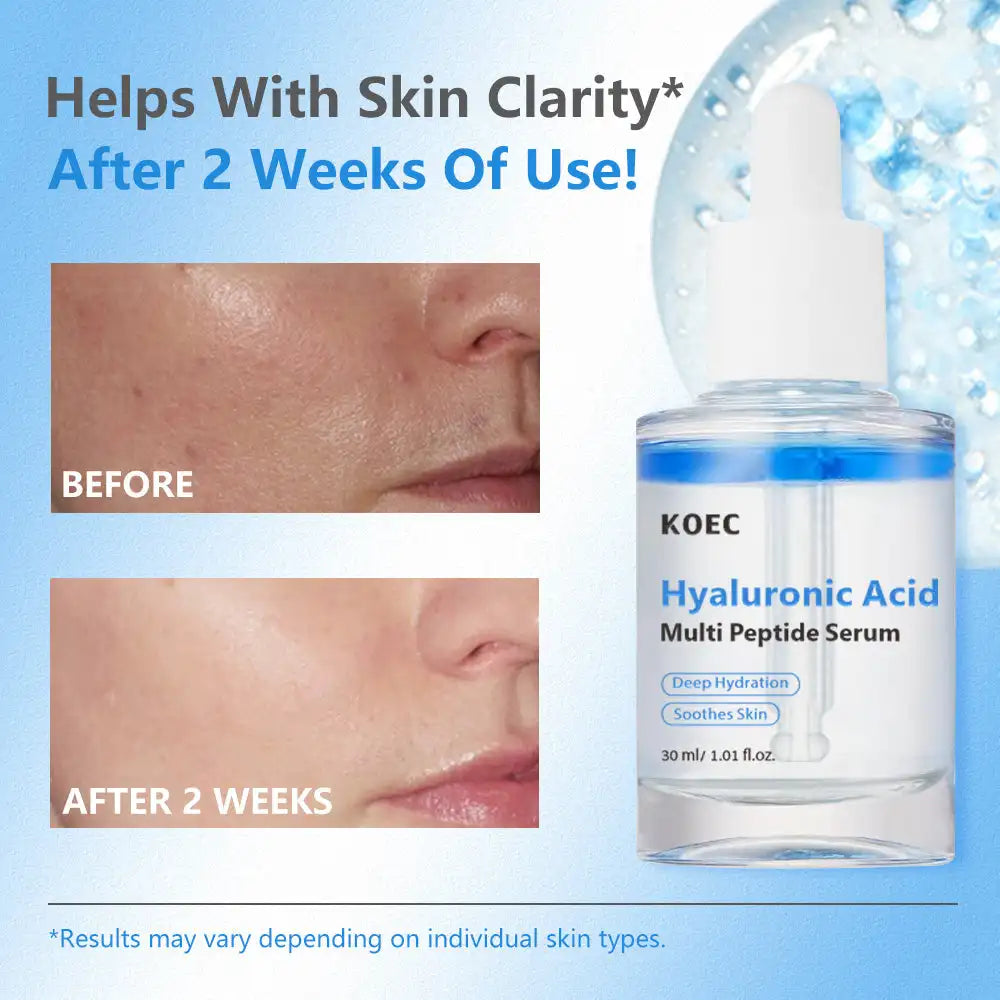 KOEC Salmon PDRN Serum – Hydrating & Firming